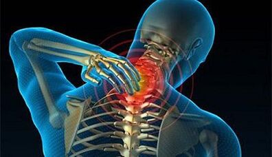 Symptoms of cervical spinal osteochondrosis