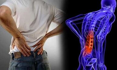 Reason -Seconds of the development of lumbar osteochondrosis
